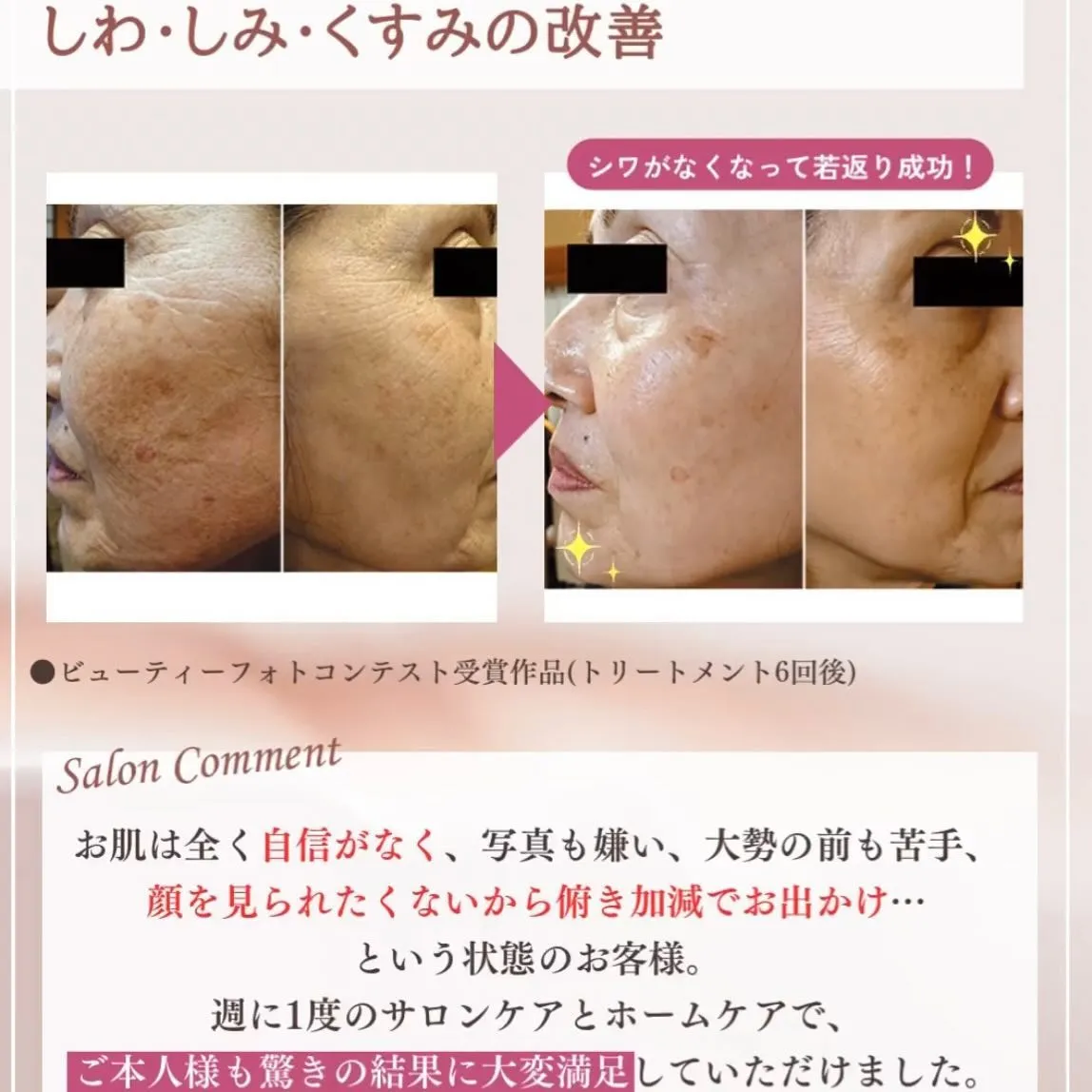 exuviance はシミ、シワに効果あり!◎